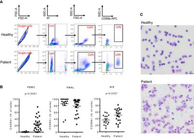 Identification of Novel Low-Density Neutrophil Markers Through Unbiased High-Dimensional Flow Cytometry Screening in Non-Small Cell Lung Cancer Patients